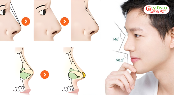 Thiết kế dáng mũi nam tính theo tỷ lệ khuôn mặt