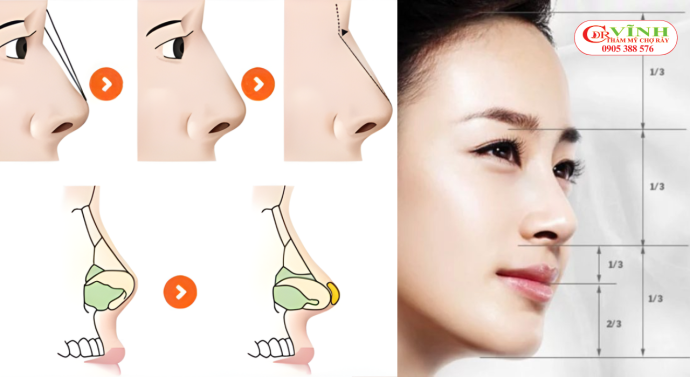 Tỷ lệ vàng nâng mũi cho từng gương mặt