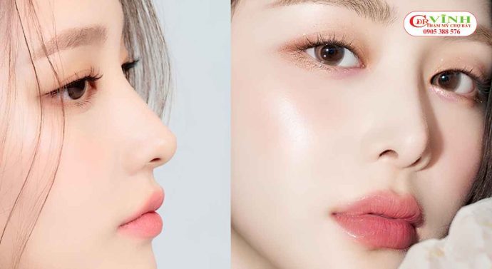 Ưu tiên dáng mũi có độ cao vừa phải để tạo sự hài hòa và giữ nét tự nhiên cho người có da mỏng