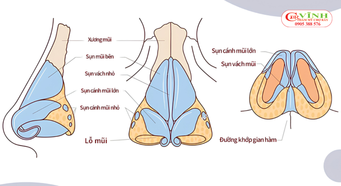 Cấu trúc nền mũi cần được đánh giá trực tiếp trước khi xác định phương án nâng mũi phù hợp