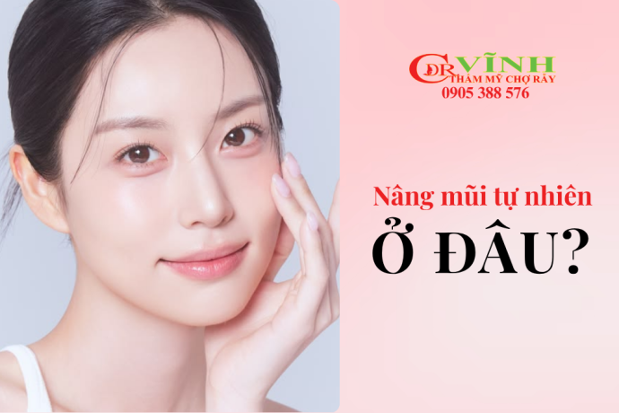 Nâng mũi tự nhiên ở đâu? Cách chọn địa chỉ uy tín tại TP.HCM
