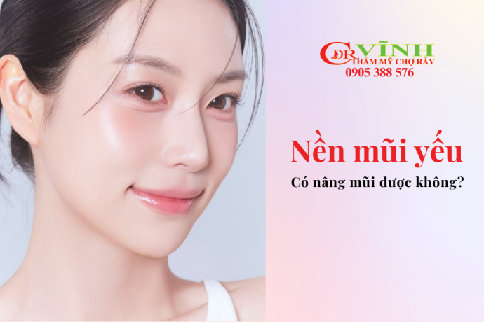Nền mũi yếu có nâng mũi được không? Giải pháp an toàn cho dáng mũi tự nhiên