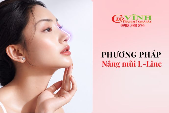 Nâng mũi L-Line: Dáng mũi, Quy trình, Chi phí & Lưu ý