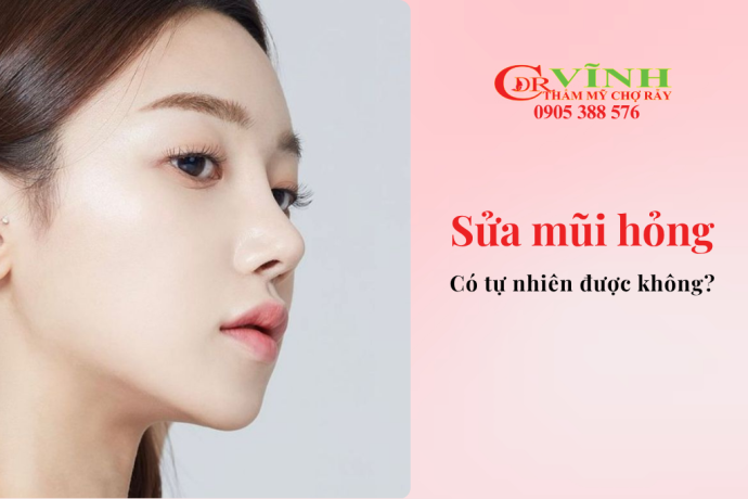 Sửa mũi hỏng có tự nhiên được không? Giải pháp tái tạo dáng mũi hài hòa